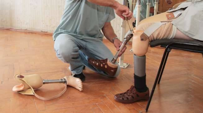 Abogada de amputación